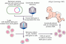 ADA-SCID Gene Therapy